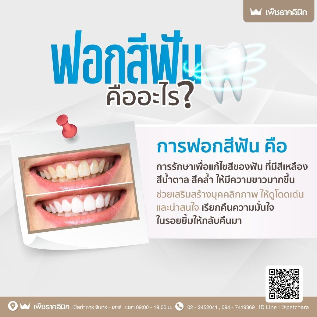 การรักษษเพื่อแก้ไขสีของฟัน