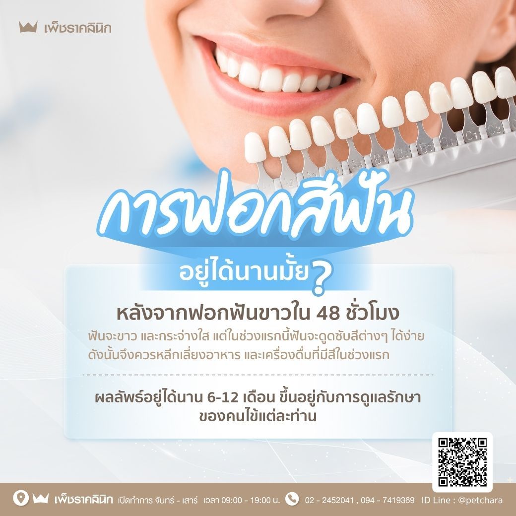 ฟอกสีฟันอยู่ได้นานไหม ฟอกสีฟันอยู่ได้นานไหม
โดยทั่วไปแล้ว ผลลัพธ์ของการฟอกสีฟันสามารถคงอยู่ได้ประมาณ 6 เดือนถึง 2 ปี ขึ้นอยู่กับปัจจัยหลายประการ ดังนี้
วิธีการฟอกสีฟัน: การฟอกสีฟันในคลินิกโดยทันตแพทย์มักจะให้ผลลัพธ์ที่คงทนกว่าการฟอกสีฟันที่บ้าน เนื่องจากใช้สารฟอกสีที่มีความเข้มข้นสูงกว่าและควบคุมโดยผู้เชี่ยวชาญ
สภาพฟันเริ่มต้น: หากฟันของคุณมีคราบหรือสีคล้ำมาก อาจต้องใช้เวลาในการฟอกสีฟันนานขึ้น และผลลัพธ์อาจอยู่ได้ไม่นานเท่ากับฟันที่มีสีอ่อนอยู่แล้ว
การดูแลรักษาหลังฟอกสีฟัน: การดูแลสุขภาพช่องปากที่ดีและหลีกเลี่ยงอาหารและเครื่องดื่มที่ทำให้ฟันเปลี่ยนสี เช่น ชา กาแฟ ไวน์แดง และบุหรี่ จะช่วยยืดอายุของผลลัพธ์การฟอกสีฟันได้
เพื่อให้ฟันขาวอยู่ได้นานขึ้น คุณควร:
แปรงฟันอย่างน้อยวันละ 2 ครั้ง: ใช้ยาสีฟันที่มีส่วนผสมของฟลูออไรด์ และแปรงฟันอย่างถูกวิธีเป็นเวลา 2 นาทีต่อครั้ง
ใช้ไหมขัดฟันทุกวัน: ช่วยทำความสะอาดซอกฟันที่แปรงสีฟันเข้าไม่ถึง
ใช้น้ำยาบ้วนปาก: ช่วยลดแบคทีเรียในช่องปากและป้องกันคราบพลัค
หลีกเลี่ยงอาหารและเครื่องดื่มที่ทำให้ฟันเปลี่ยนสี: หรือดื่มน้ำตามทันทีหลังจากบริโภค
พบทันตแพทย์เพื่อตรวจสุขภาพช่องปากและฟอกสีฟันซ้ำเป็นประจำ: ตามคำแนะนำของทันตแพทย์
ด้วยการดูแลรักษาที่เหมาะสม คุณสามารถเพลิดเพลินกับรอยยิ้มที่สดใสและมั่นใจได้ยาวนานยิ่งขึ้น