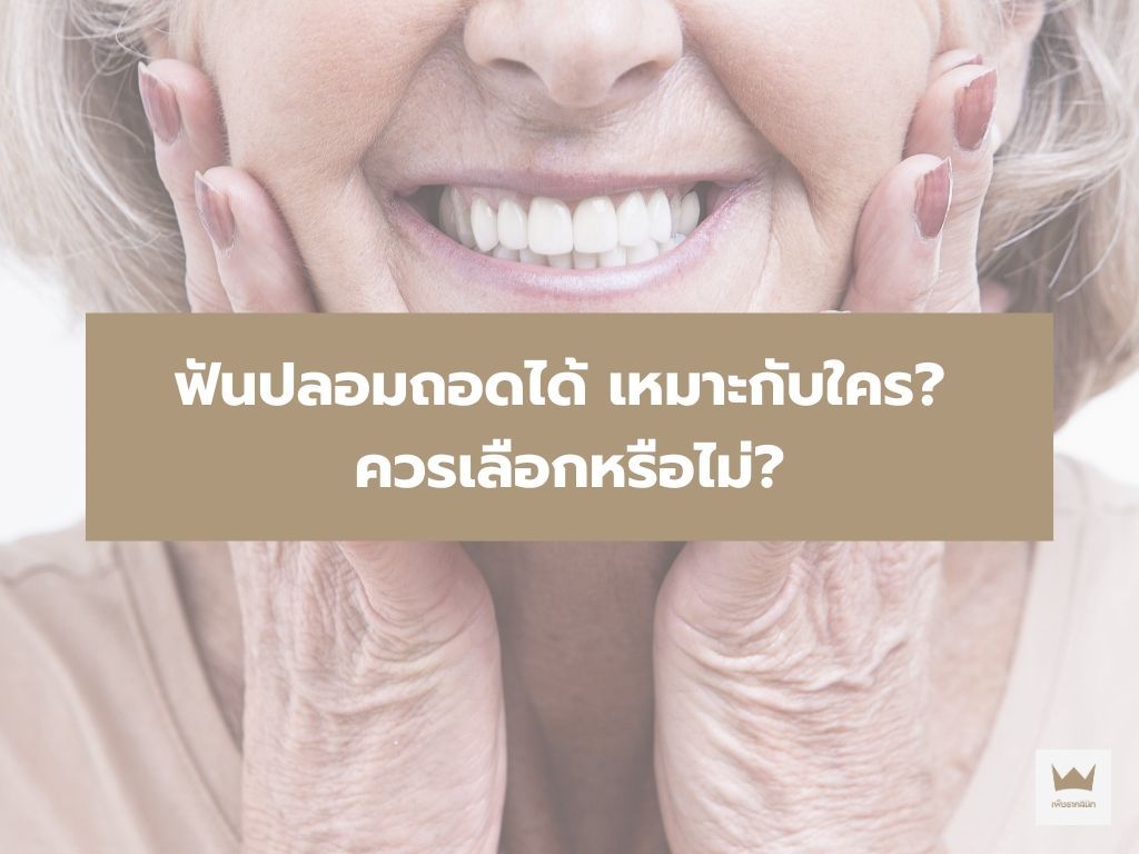 ฟันปลอมถอดได้ เหมาะกับใคร? ควรเลือกหรือไม่?