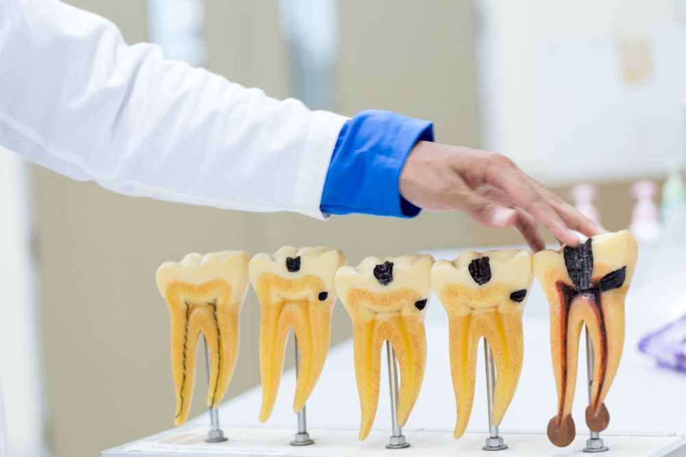 root-canal-vs-extraction