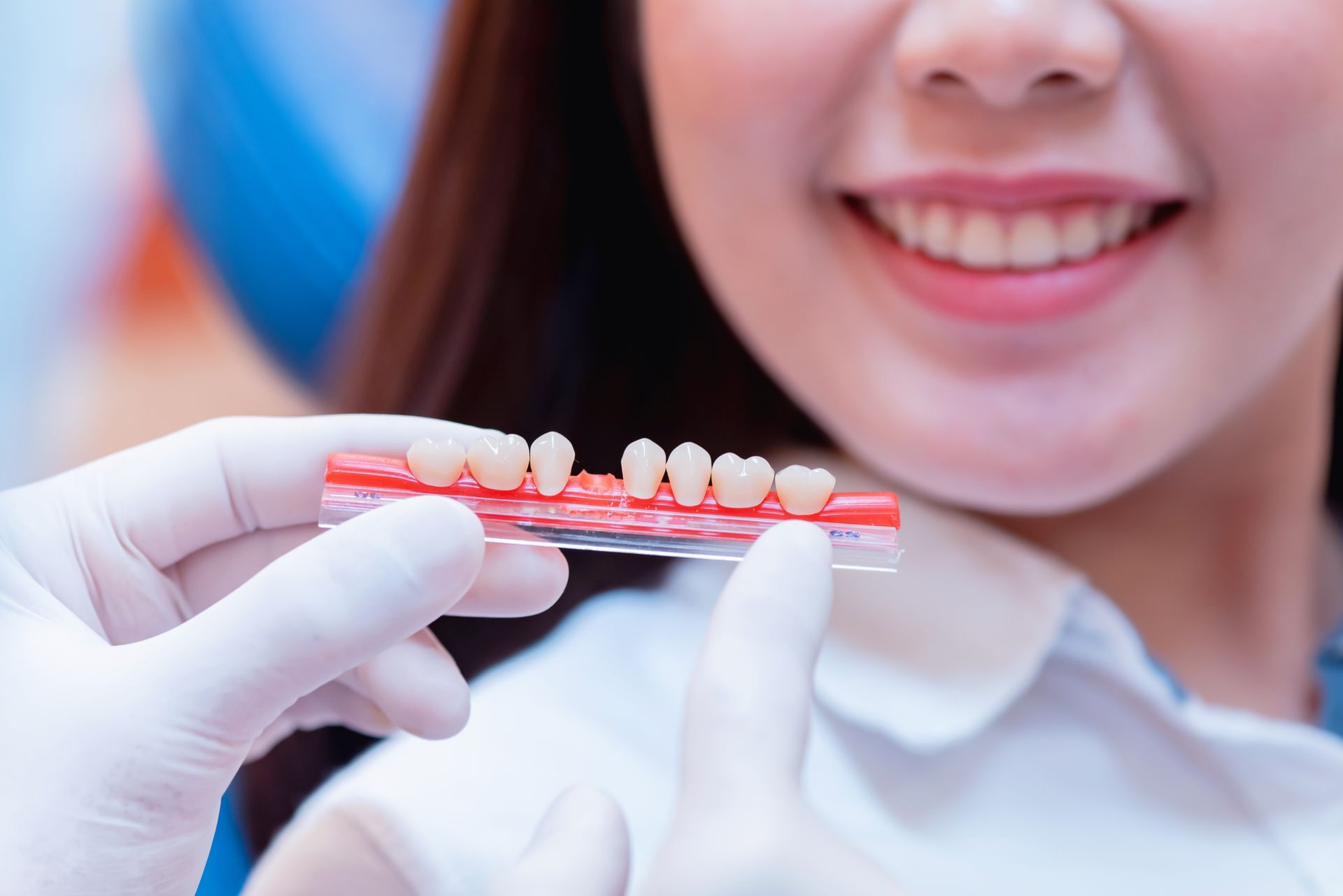 วีเนียร์ (Veneer) คือ การเคลือบฟันด้วยวัสดุบางๆ ที่มีสีเหมือนฟันธรรมชาติ โดยติดลงบนผิวหน้าฟัน เพื่อแก้ไขปัญหาฟันที่ไม่สมบูรณ์ ไม่ว่าจะเป็นปัญหาสีฟันที่คล้ำ ฟันแตก ฟันบิ่น หรือรูปร่างของฟันที่ไม่สวยงาม วีเนียร์ช่วยให้ฟันของคุณดูดีขึ้นและเป็นธรรมชาติมากขึ้น