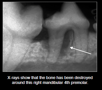 AAH periodontal radiograph