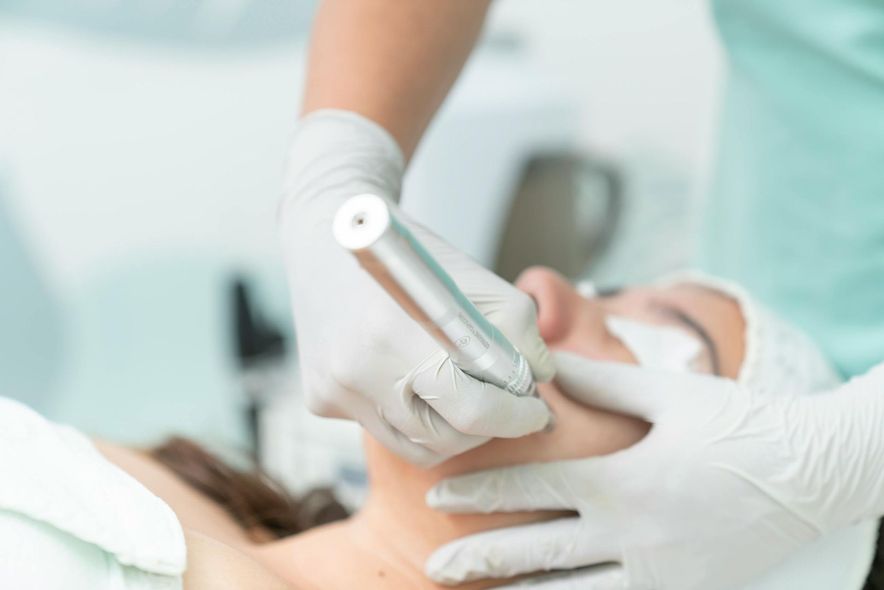 Person undergoing a skin treatment on their face, performed by someone wearing gloves in a medical setting.