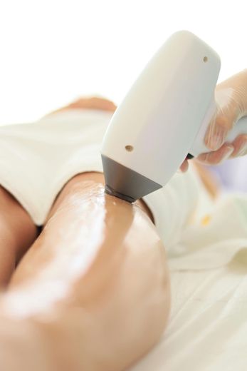 Laser hair removal treatment on a leg, white device, fair skin.
