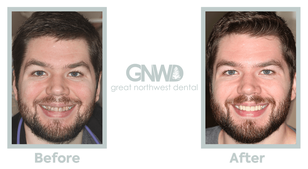 Cosmetic Dentistry Before/After