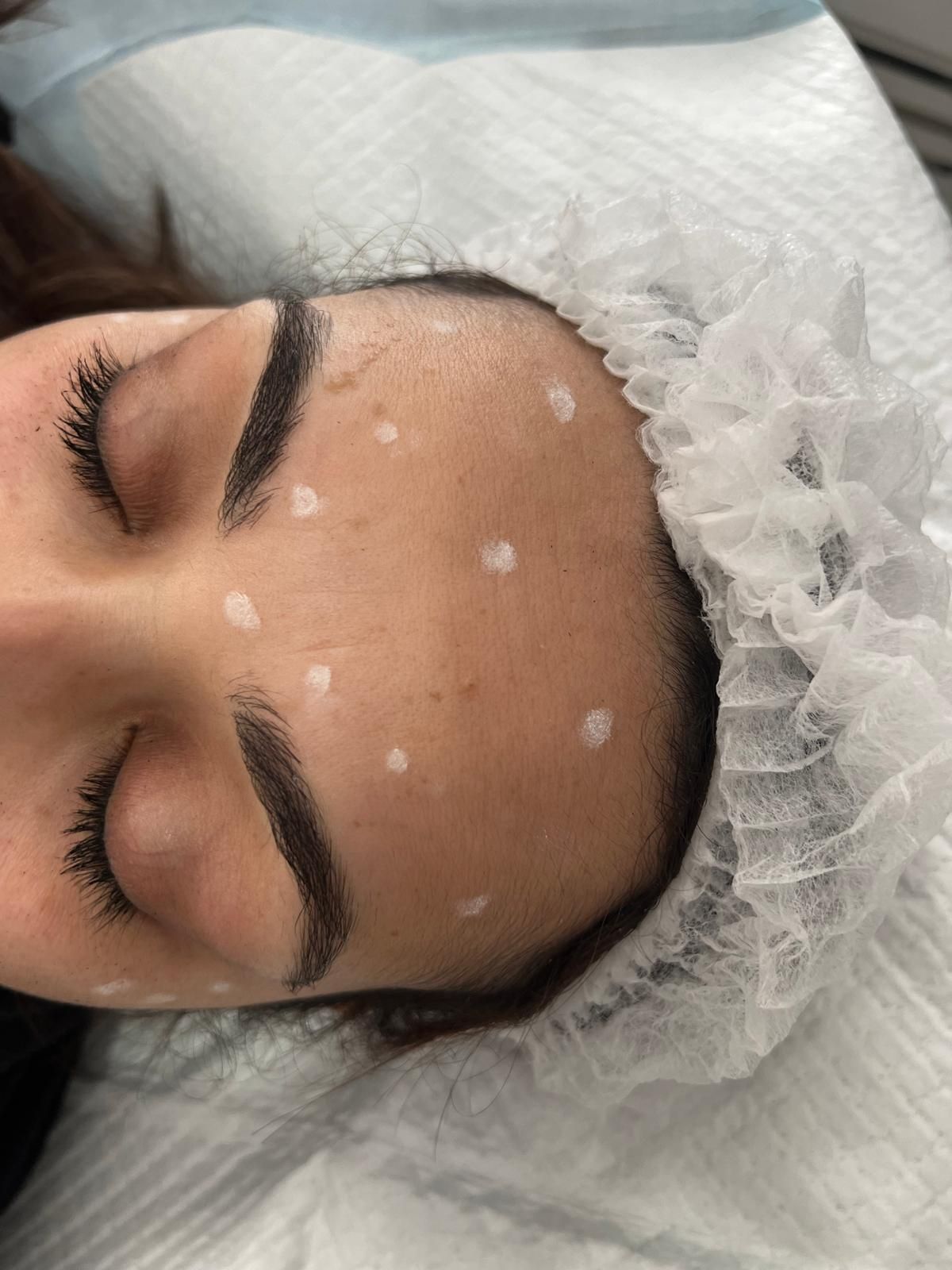 Close up of a woman about to have an aesthetic treatment