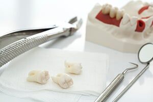 Dental Equipment - Wisdom Teeth in Schererville, IN