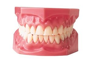 Model Dentures - Dentures in Schererville, IN
