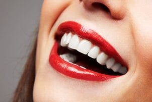 Woman Smiling — cosmetic dentistry in Schererville, IN