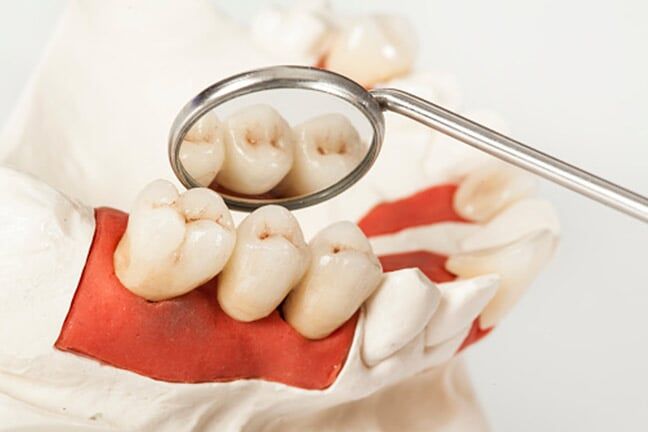 Dental health care - Oral Health in Schererville, IN