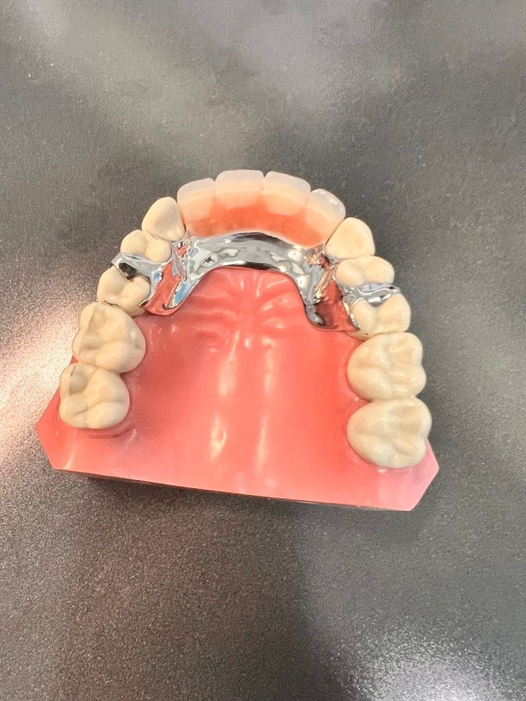 A Person is Holding a Model of a Tooth — Central Coast Denture Clinic Erina In Erina, NSW