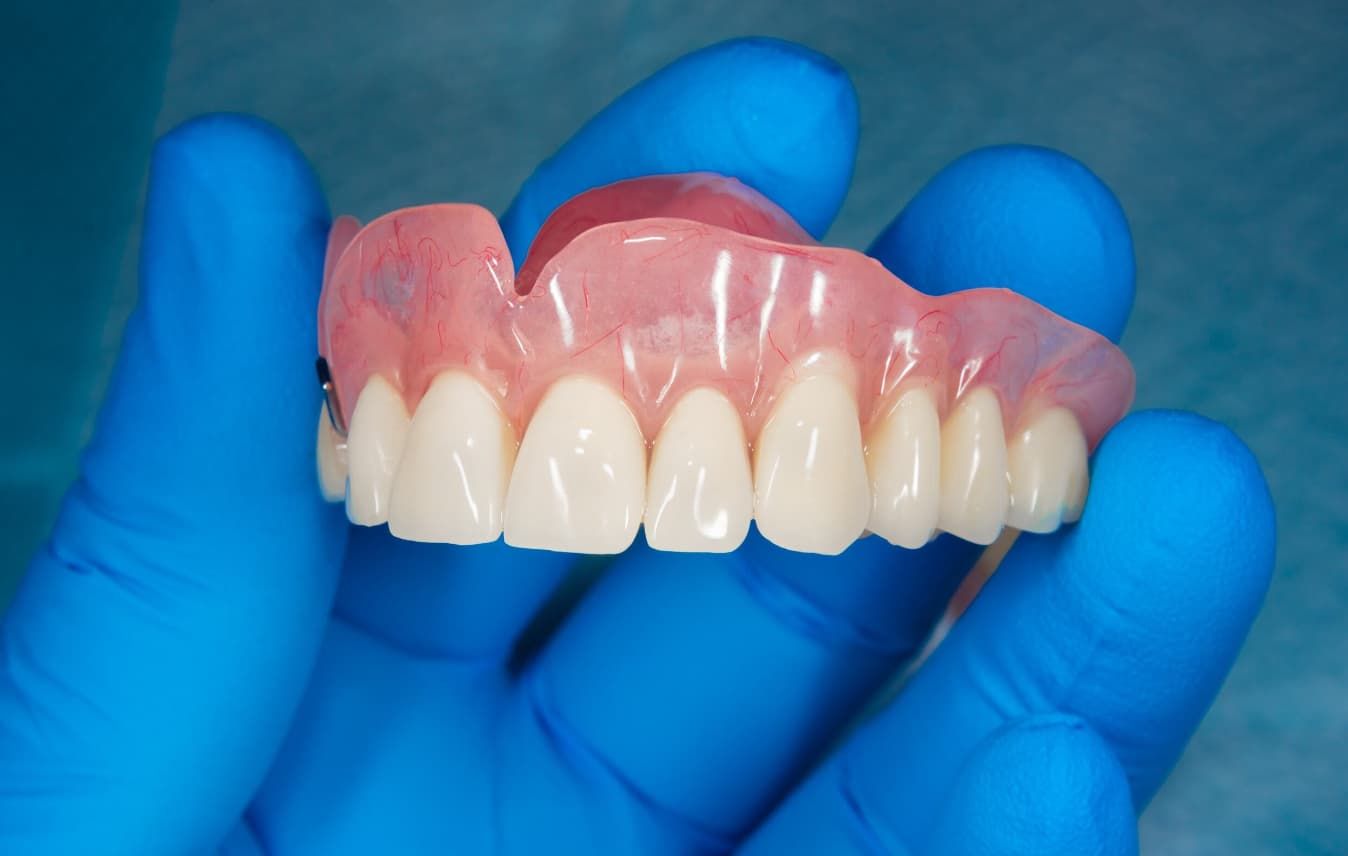 A Person Is Holding A Acrylic Denture In Their Hand — Central Coast Denture Clinic Erina In Erina, NSW
