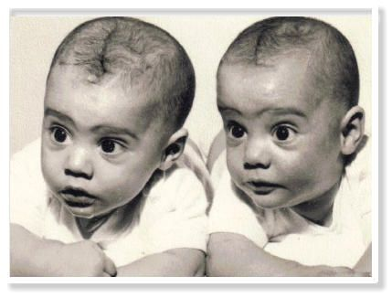 A black-and-white, close-up shot of two infants lying side-by-side, both looking forward with wide, curious eyes.