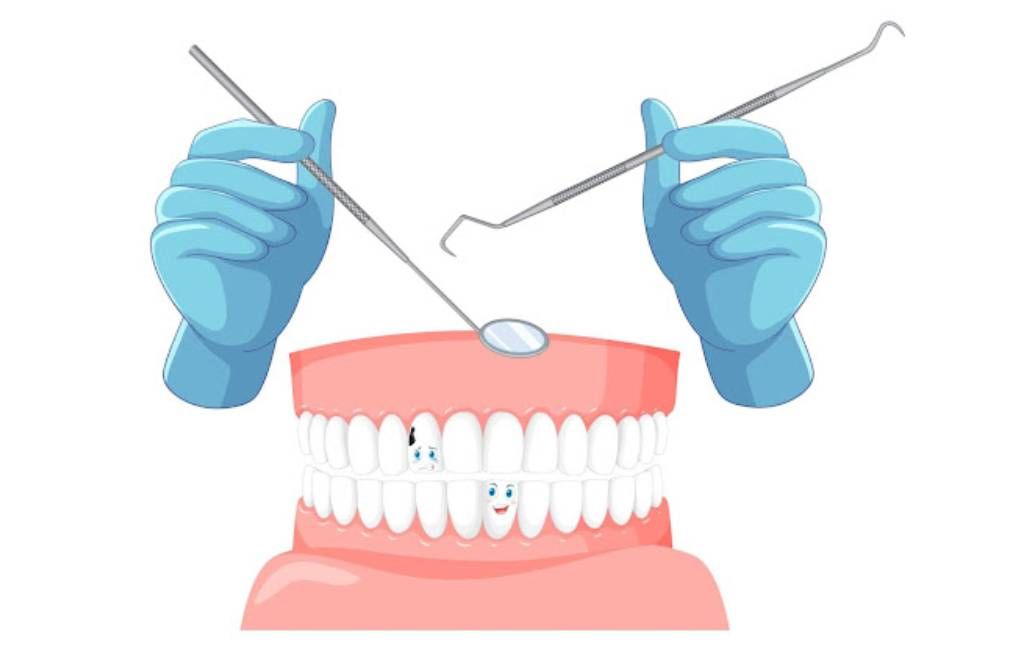 Dental cleaning illustration with gloved hands using tools on open teeth and gums