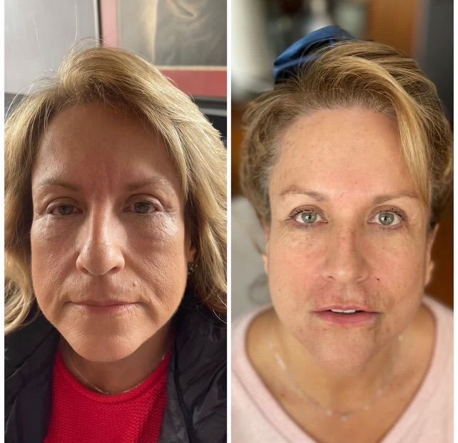A before and after photo of a woman's face.