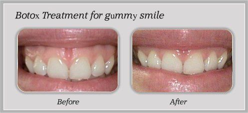 treatment before and after