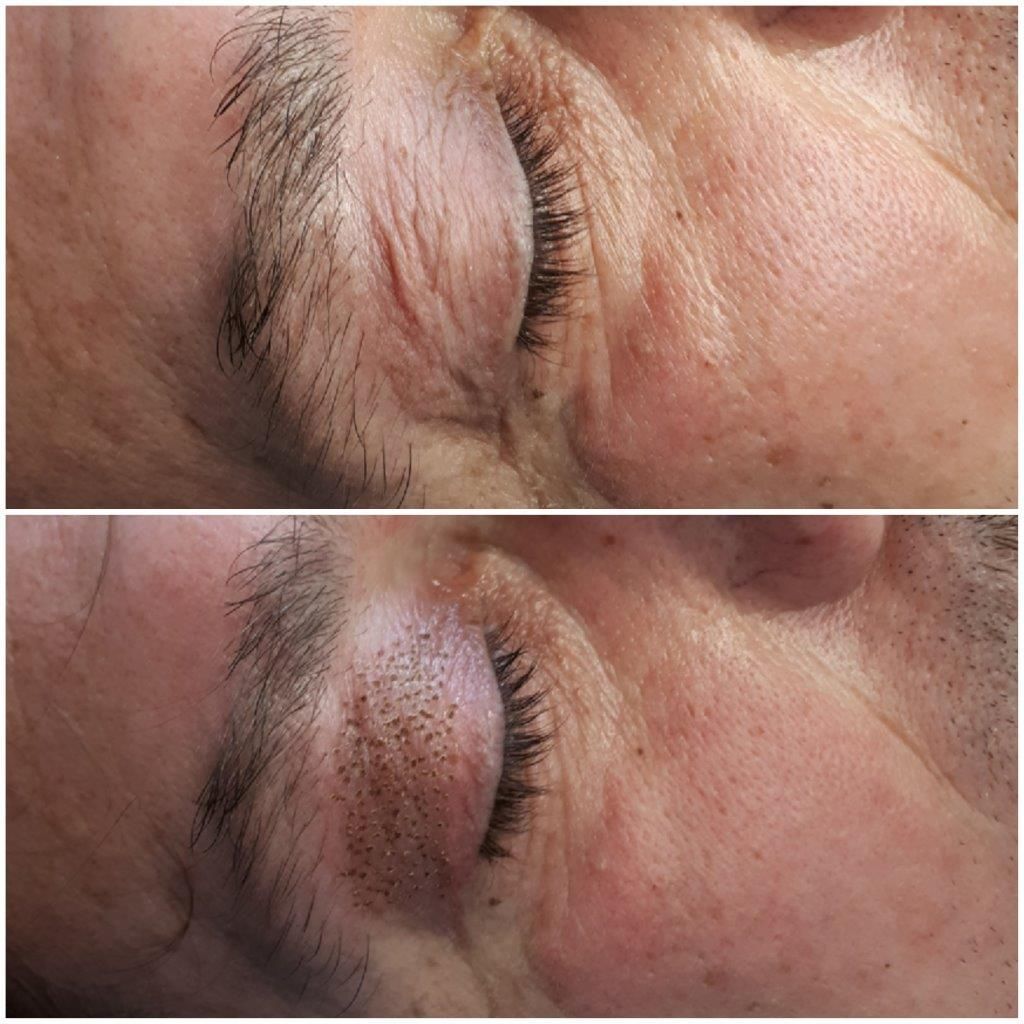 Ein Vorher-Nachher-Foto der Augenbrauen einer Frau