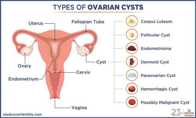 60-pelvic-pain-location-diagram-gailorlaith