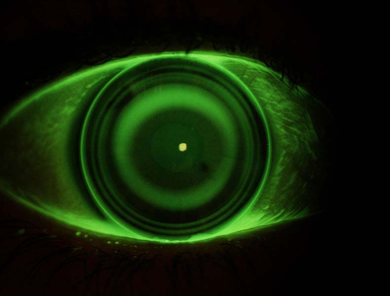 Un occhio visto con visione notturna