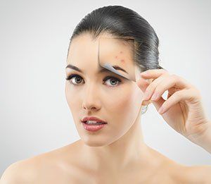Acne Skin Treatments | The Skin Studio | Queenstown, Wanaka