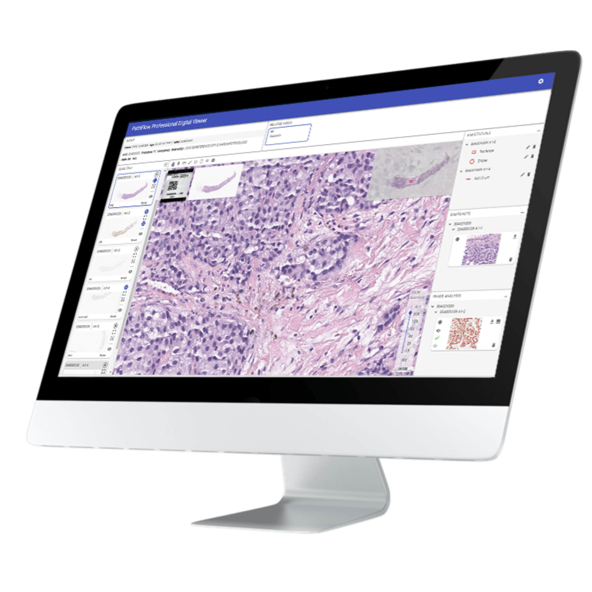 Digital Pathology Workflow