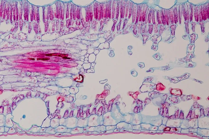 digital pathology image