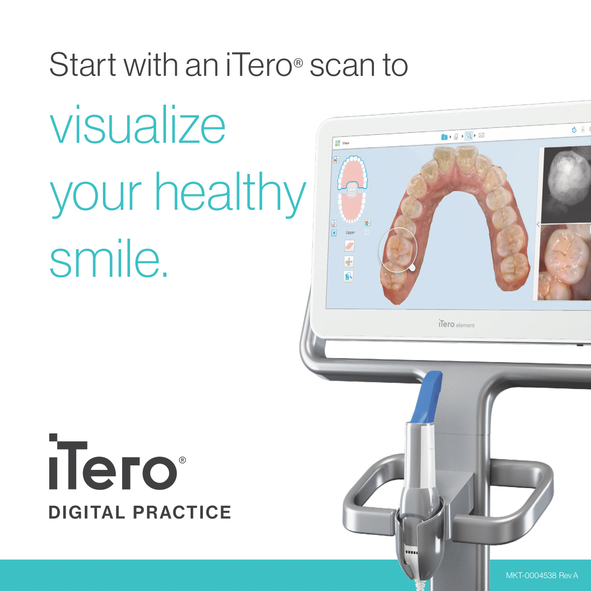 iTero scanners - Harvard Dental Centre