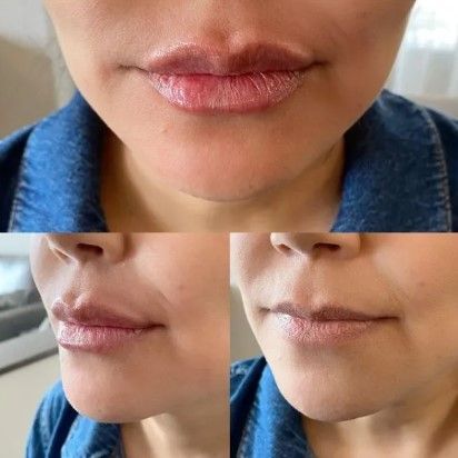 A close up of a woman 's lips with a blue shirt on.