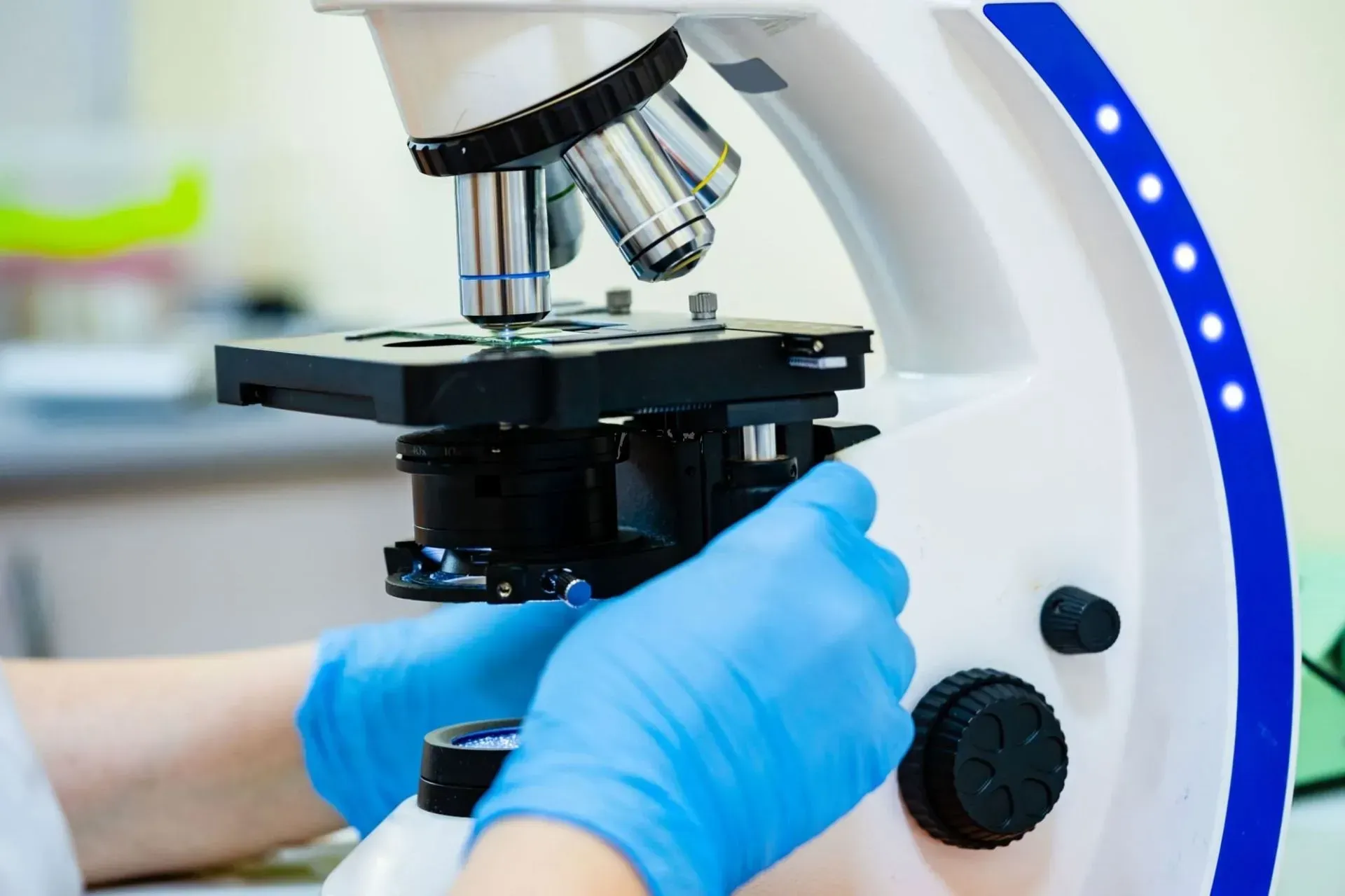 Image mycologie médicale – étude des champignons – laboratoire Marrakech