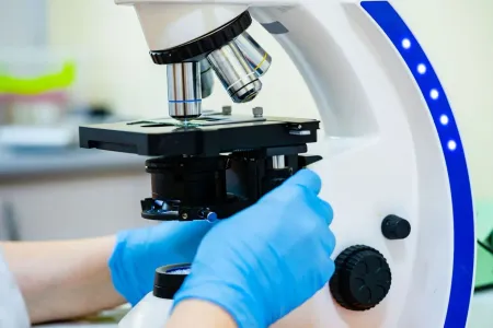 Image mycologie médicale – étude des champignons – laboratoire Marrakech