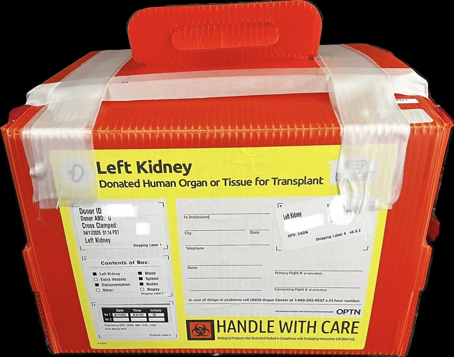 A red box that says left kidney on it