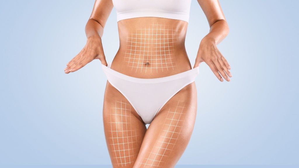 Woman in white bikini showing body contouring patches on abdomen and thighs against a blue background