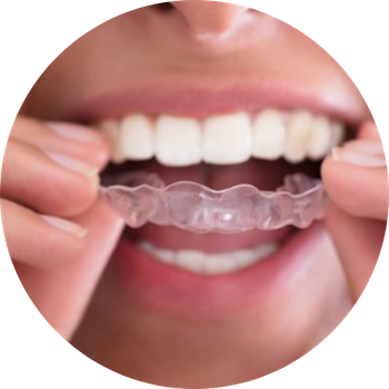 A person is holding a clear brace in their mouth