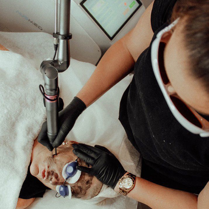 A Woman Is Using A Machine To Remove A Tattoo From A Man 's Face — Beauty & Laser by Sarah in Long Jetty, NSW