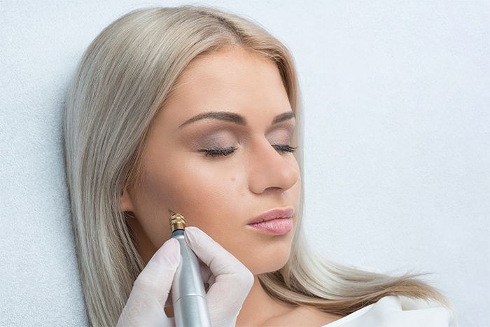 A Woman Is Getting A Treatment On Her Face — Beauty & Laser by Sarah in Long Jetty, NSW