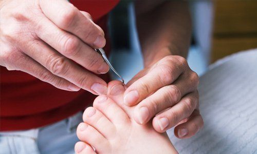 Nail care