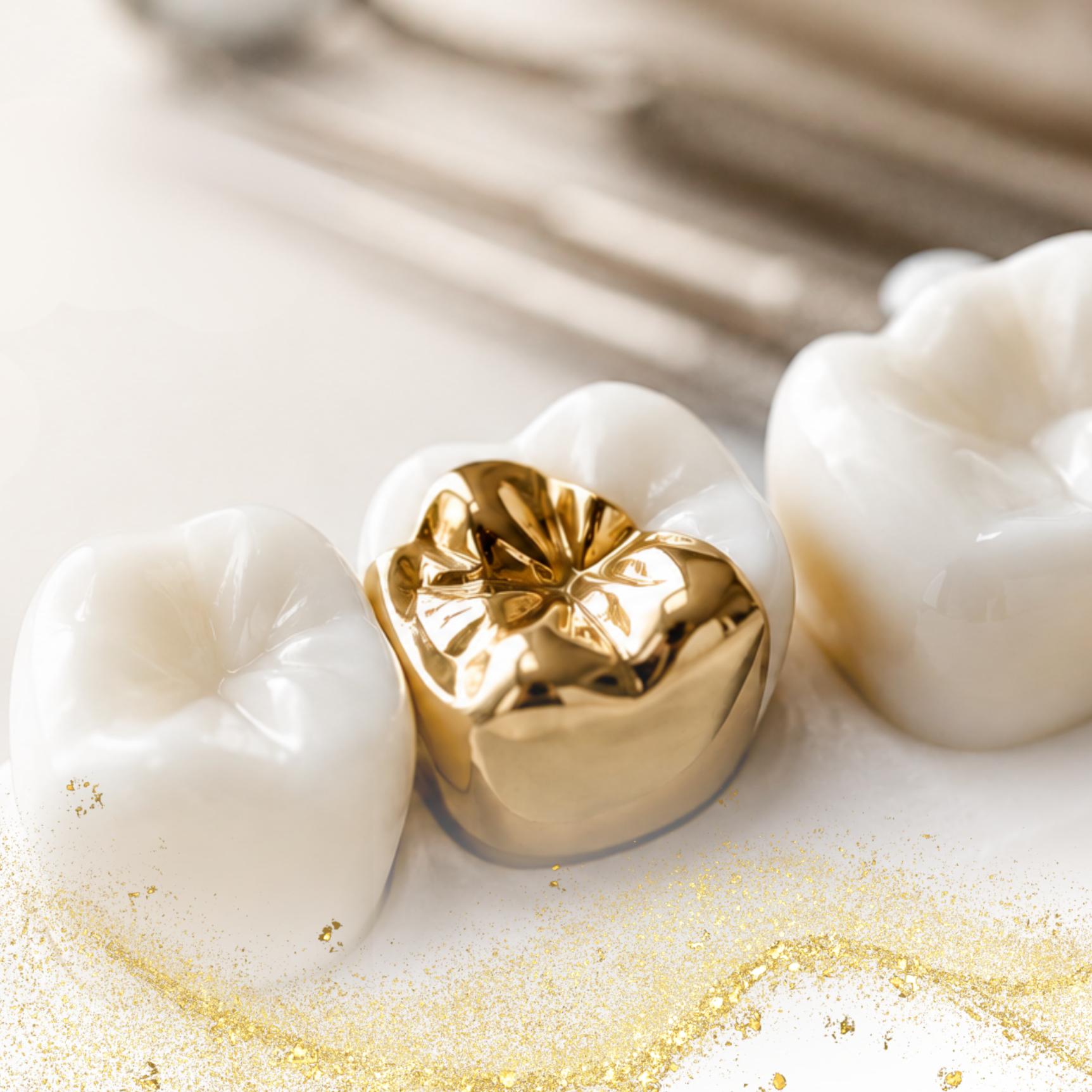 Three white dental crowns and one gold tooth crown on a light surface with gold dust