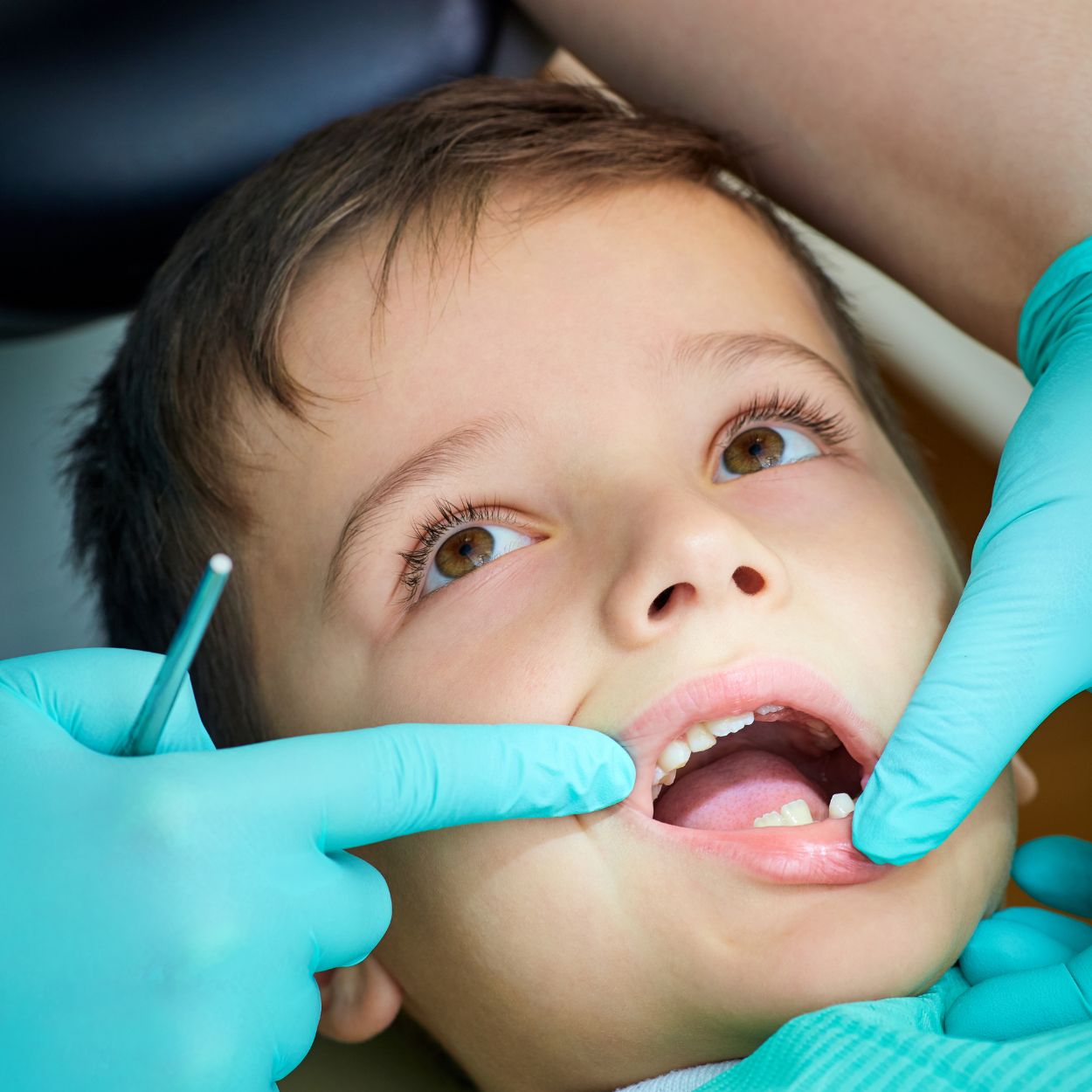 Child in a dental exam with gloved hands examining the mouth