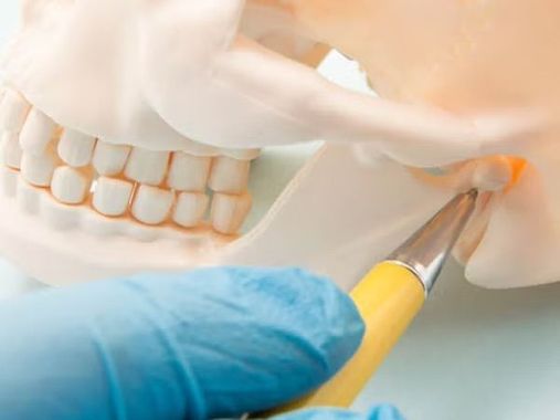 Dental mold being trimmed with a yellow-handled tool while a blue-gloved hand holds it