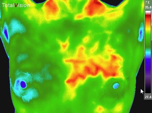 Thermography — Hudson, NY — Serenity Wellness Medical Spa