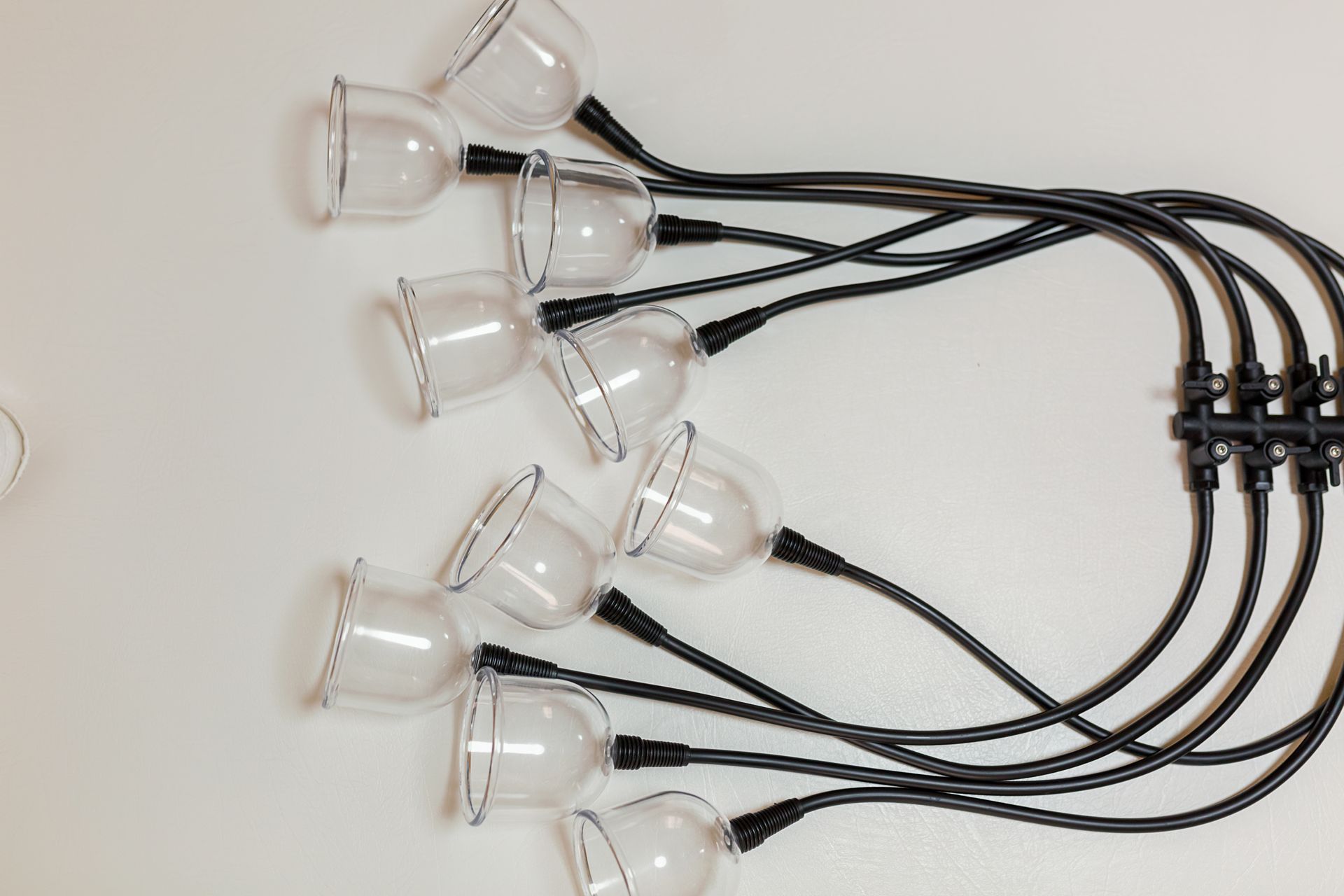 A man is getting a cupping treatment on his back.