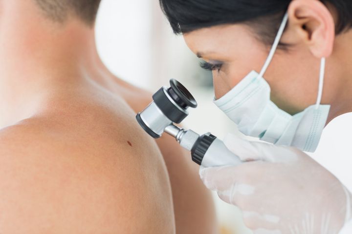 Image of dermatologist performing a skin cancer screening.