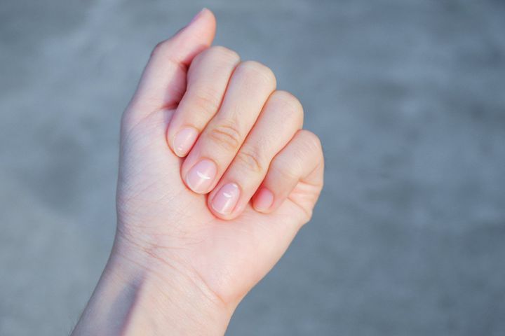 Photo of a person's hand without fingernails goes viral, shocks the  internet - but it's not CGI | Viral News, Times Now