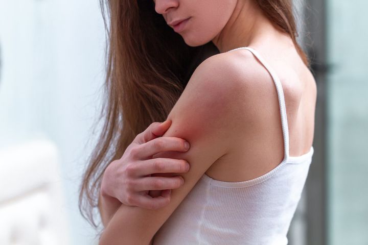 Image showing a rash that can be treated by a dermatologist.