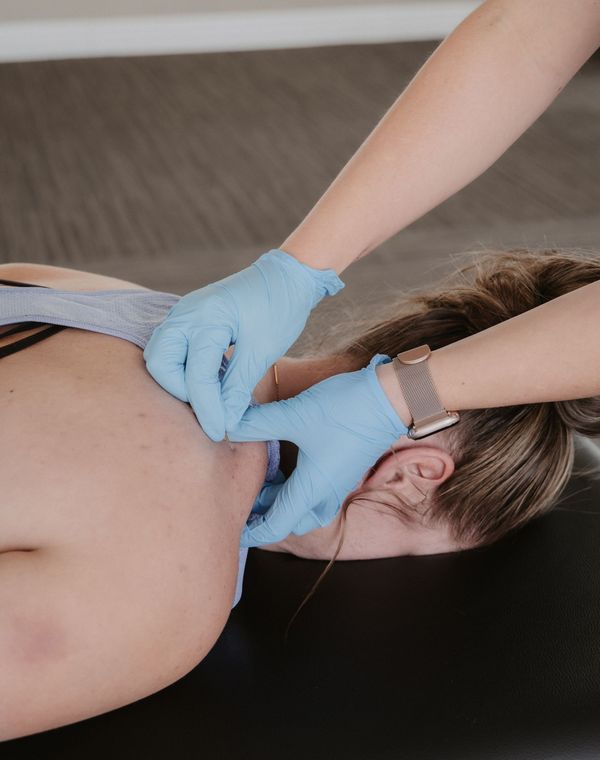 A practitioner in blue gloves performs dry needling on the upper back and neck area of a person lying on a table.