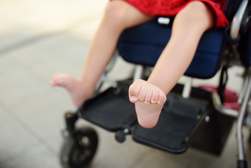 Child's bare feet extended from a wheelchair. One foot is close to the camera. — Bourbong Street Physiotherapy Centre in Bundaberg West, QLD