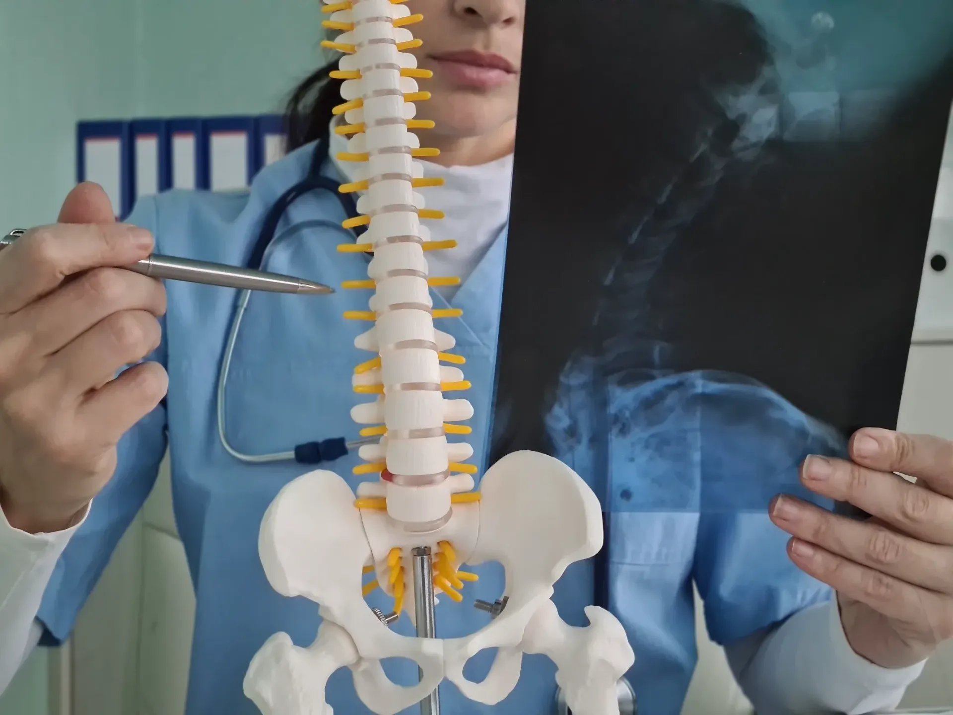 Doctor points to an X-ray, comparing it to a spinal model in an office setting — Bourbong Street Physiotherapy Centre in Bundaberg West, QLD