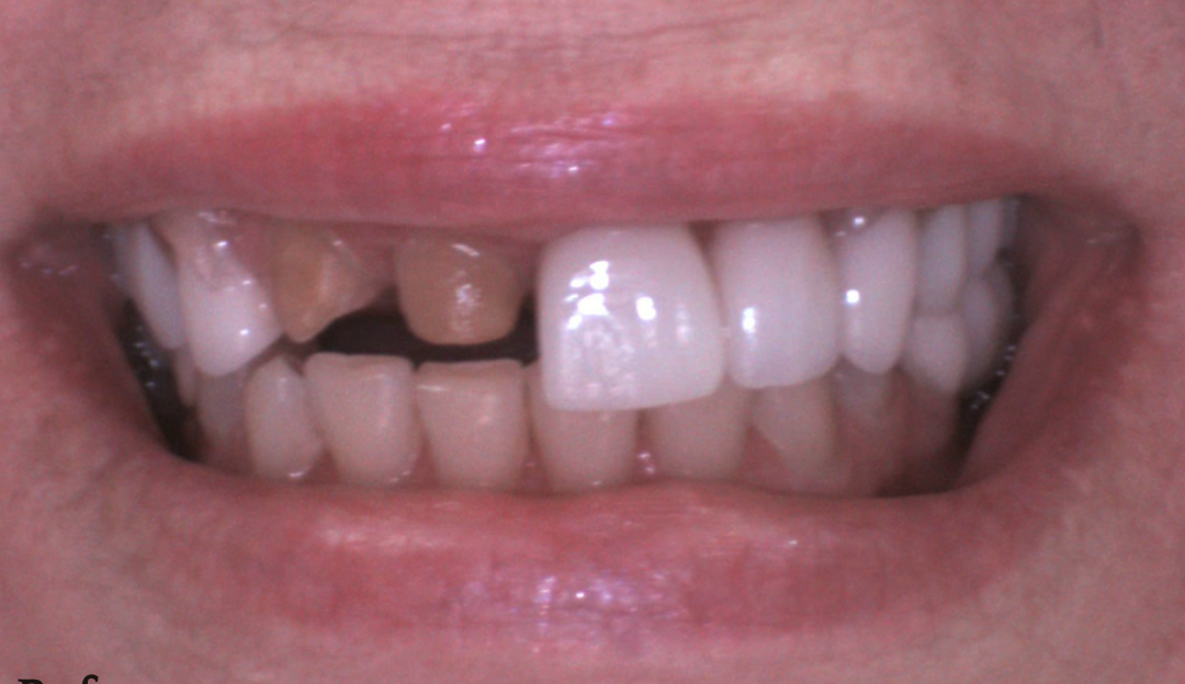 A close up of a person 's mouth with a smile on it