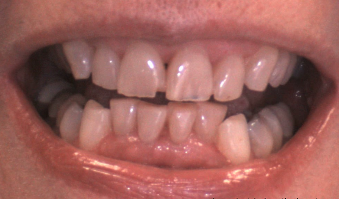 A close up of a person 's mouth with a smile on it