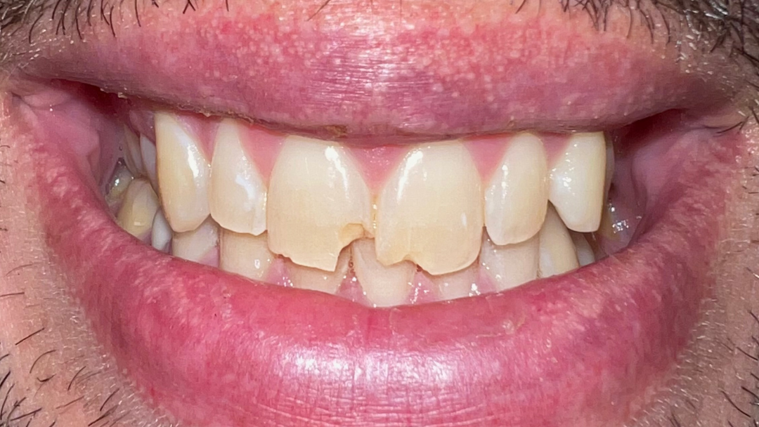 A close up of a person 's mouth with a smile on it